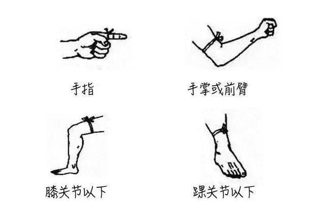 女游客被咬身亡：是三亚蛇毒还是医院渎职？｜大象夜读(图11)