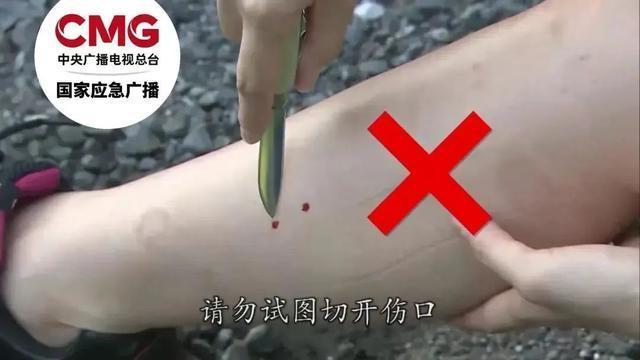 女游客被咬身亡：是三亚蛇毒还是医院渎职？｜大象夜读(图12)