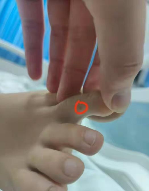 三亚蛇咬死人后续家属曝全过程俩医院恐担责女孩身份不一般(图15)